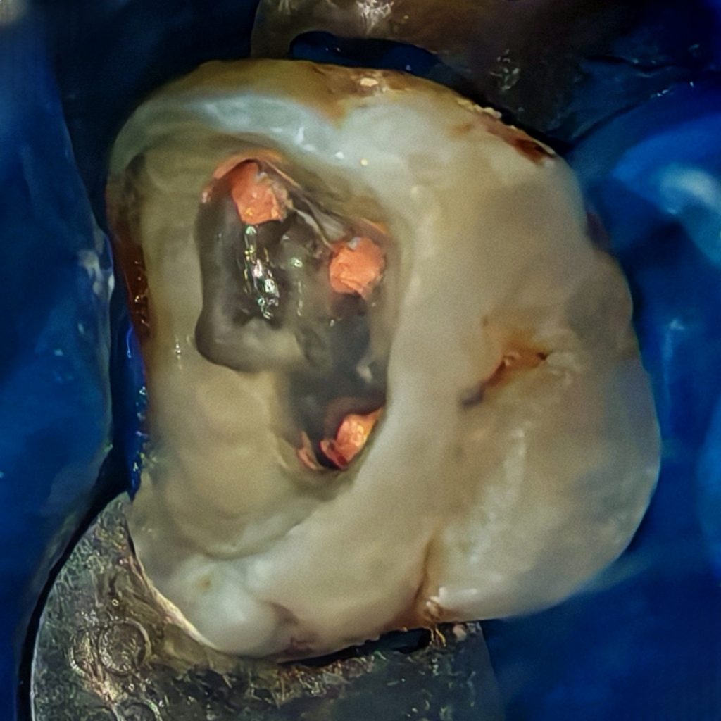 inbound6054537047541353844