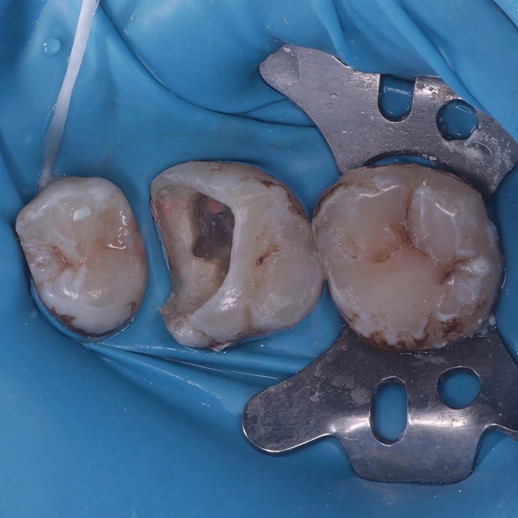 inbound7118815873152211183