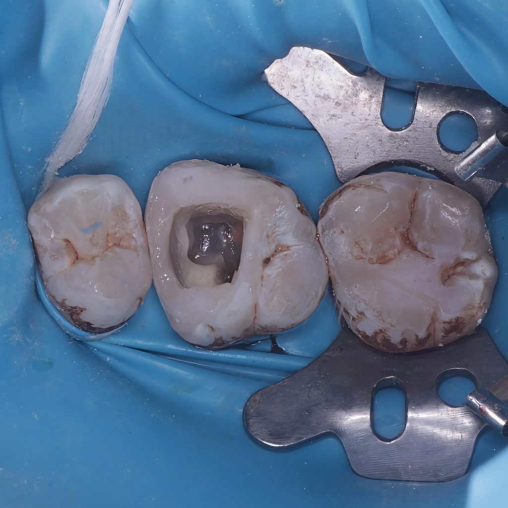 inbound7127614041261359183