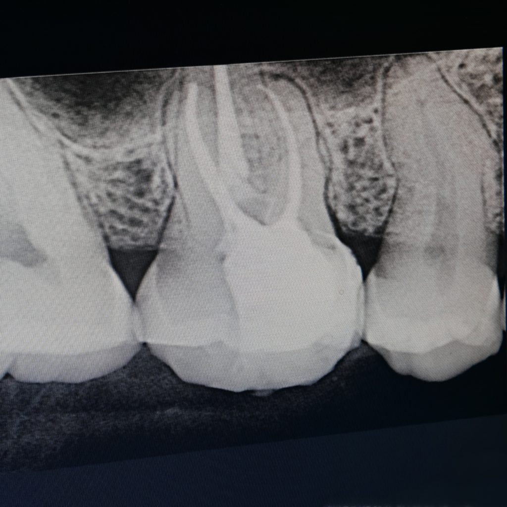 inbound8013260137734058400