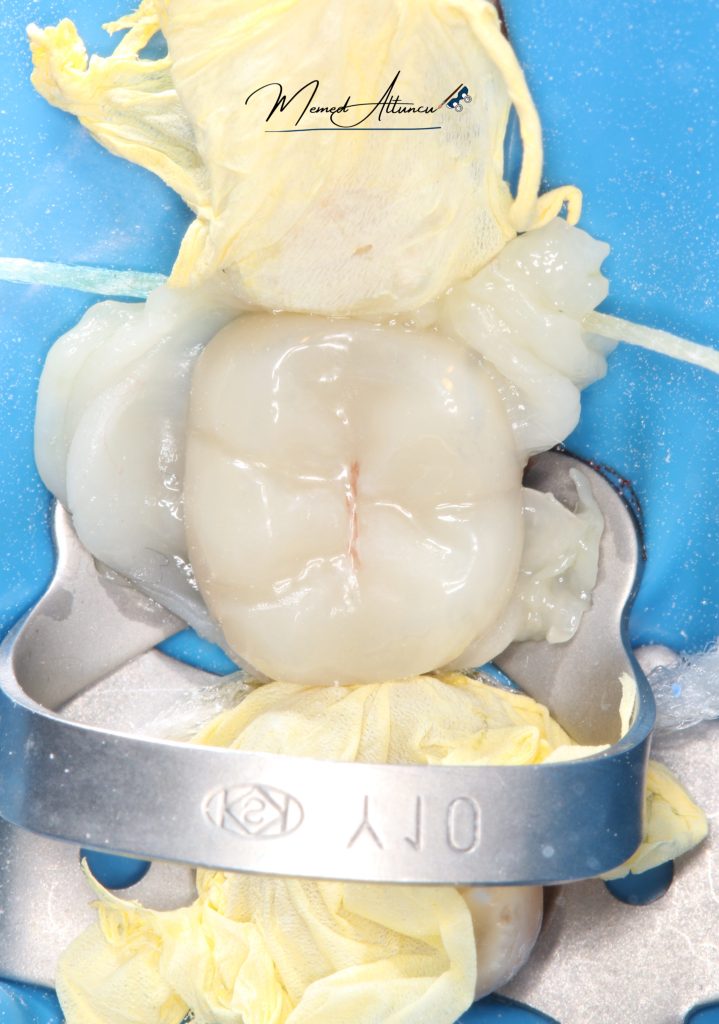 1DAC75BC-1174-40B7-B47A-67D9393175C1