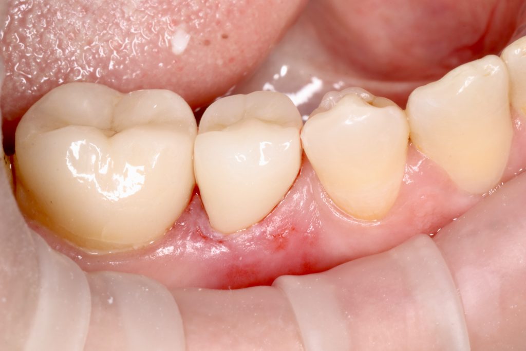 381107C5-289E-4D6C-888E-F2FCBF4656C2