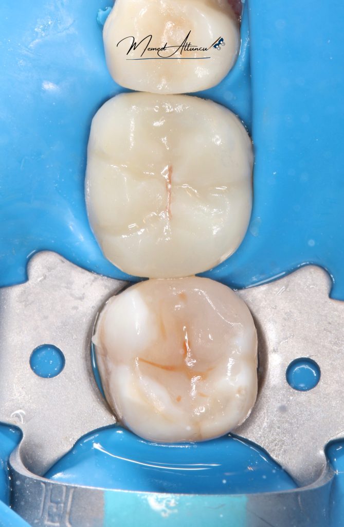 5E7ADC5F-BE76-4D76-91A1-17C3459AE65A