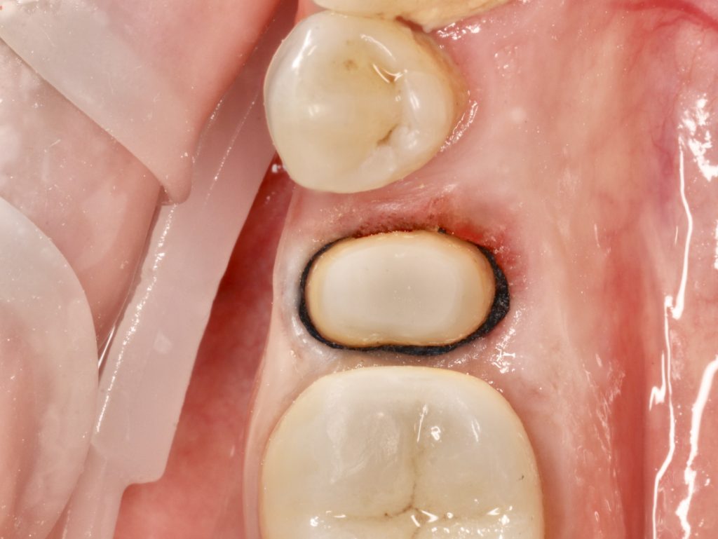 6CC79556-D4FD-4CB6-AF1F-57A16D5B4932