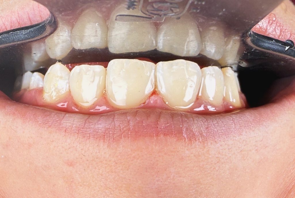 768F081D-59B2-4E34-956F-B8374A958AE3