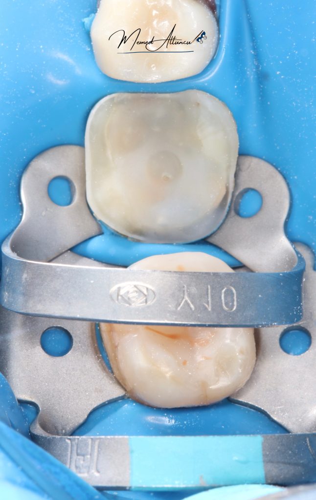 8BBC0CF1-4EB0-4491-AB37-373ADE7BFD00