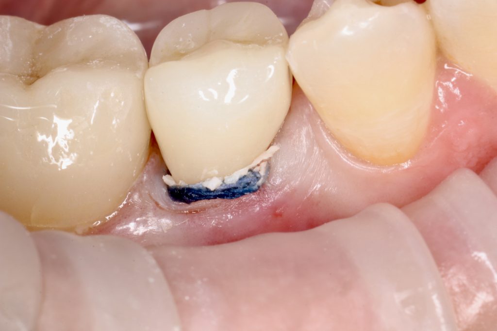 CB3E9829-4608-490A-9C42-E5116AC5950B