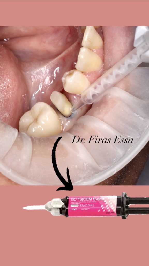 DBD44054-56A3-4B41-94D3-36686C2FFC66