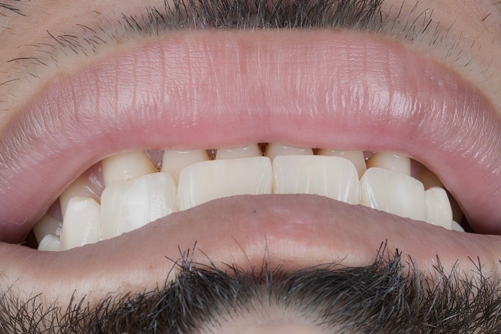 0979A89D-197C-458E-8B69-63980EC9D844