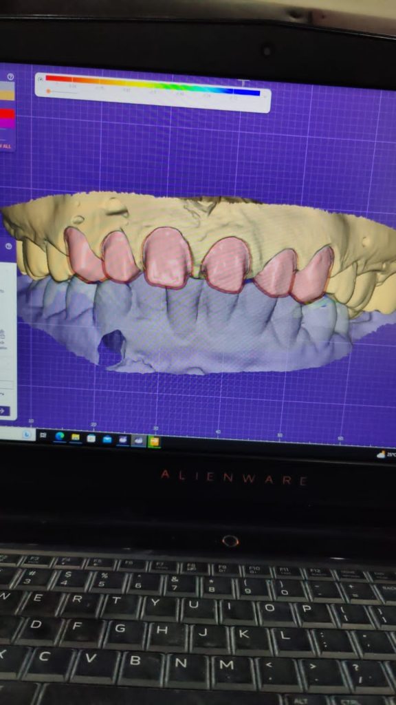 09aa6417-cbf5-47cf-9131-d3fe26afc944