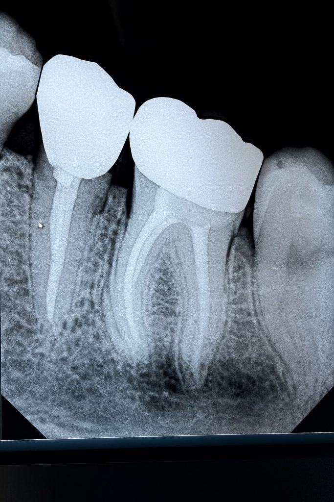 0E1B8C4A-810D-44B2-A478-7846BB5B8B9D