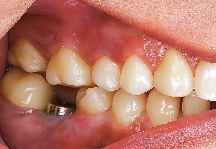 173AD3A4-64BA-4B4D-8678-1020762E2693