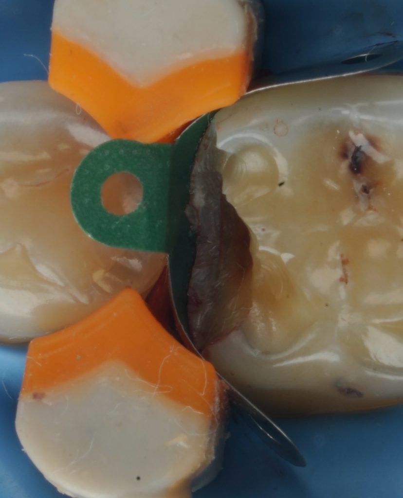 24A18571-95DD-4FA2-9FCF-F25AAF2F075A