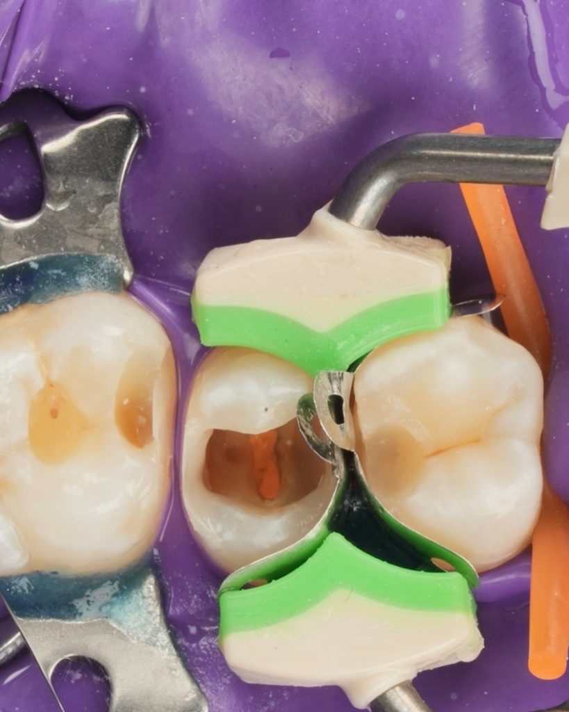 24D65FC6-4ED4-4DFD-8546-71F863200EFA