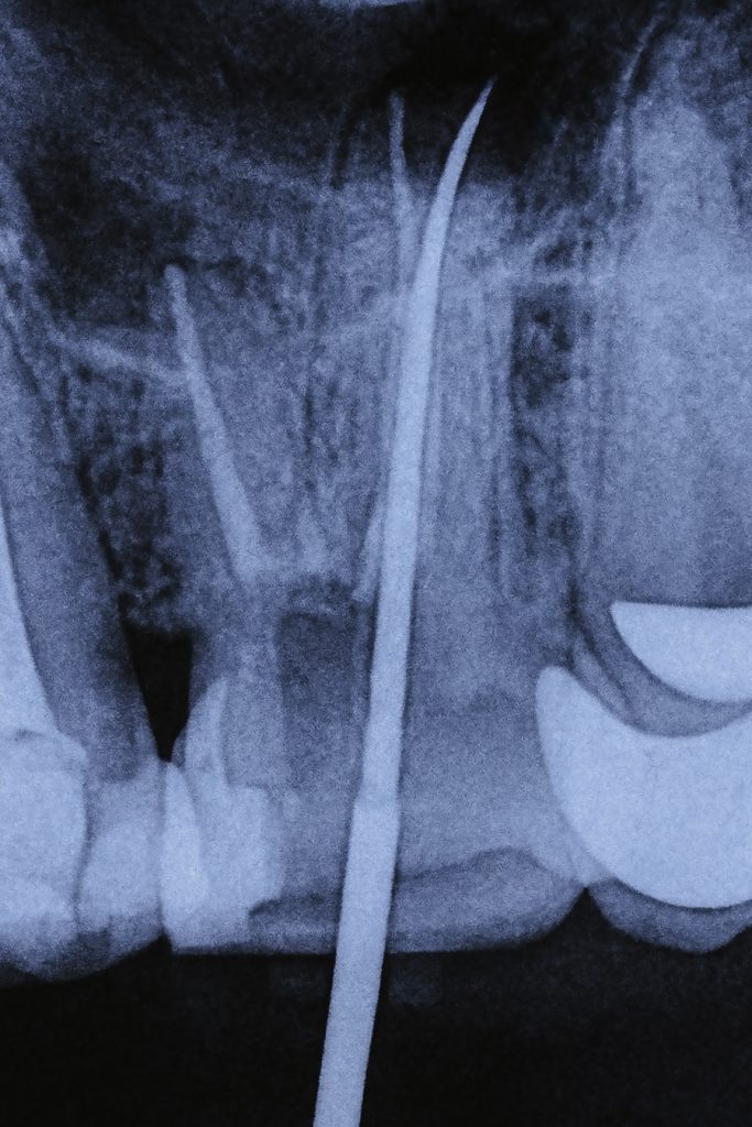 2B6D9421-B573-4209-9334-2A3968C378E3