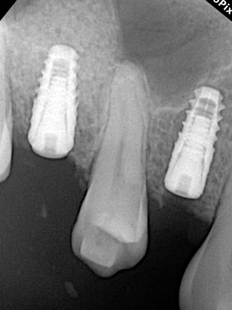 2D359E47-1776-47B9-A35A-67084B96F13E