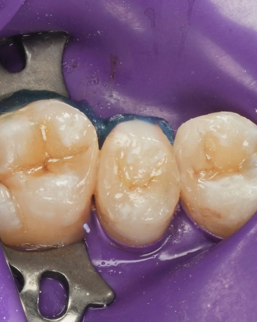 315B1DFE-3242-4603-84AC-82A38C869639