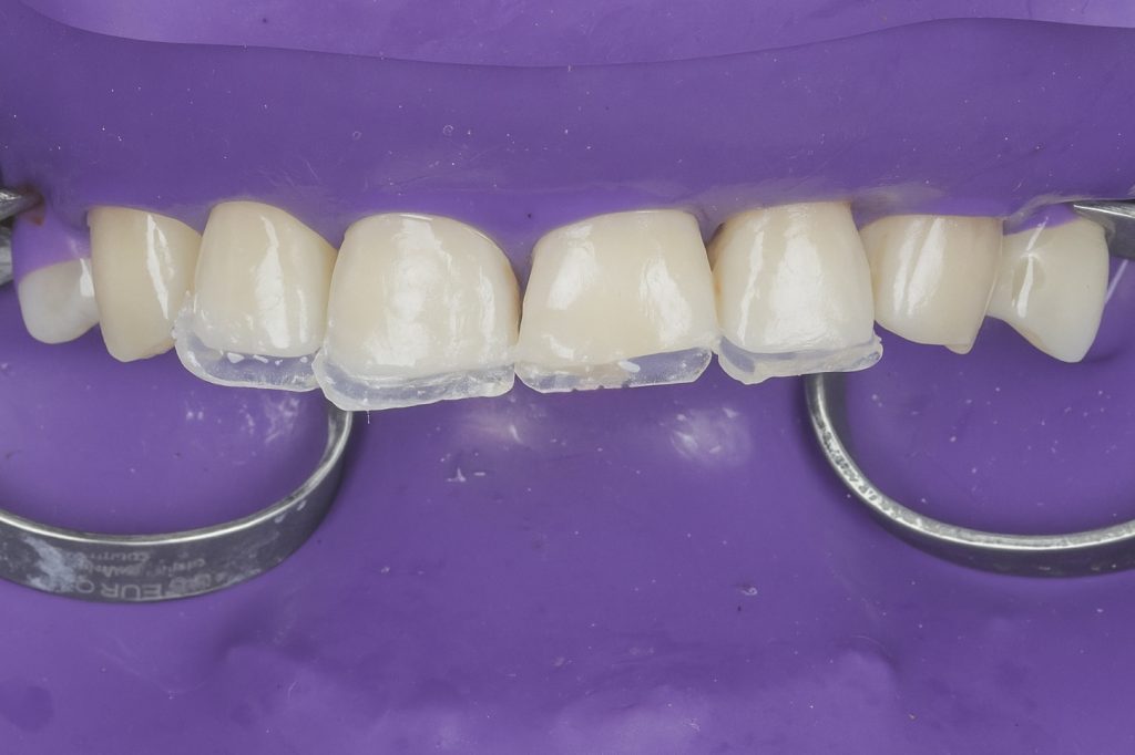 49CBD964-A7BA-4646-832D-166D65577680