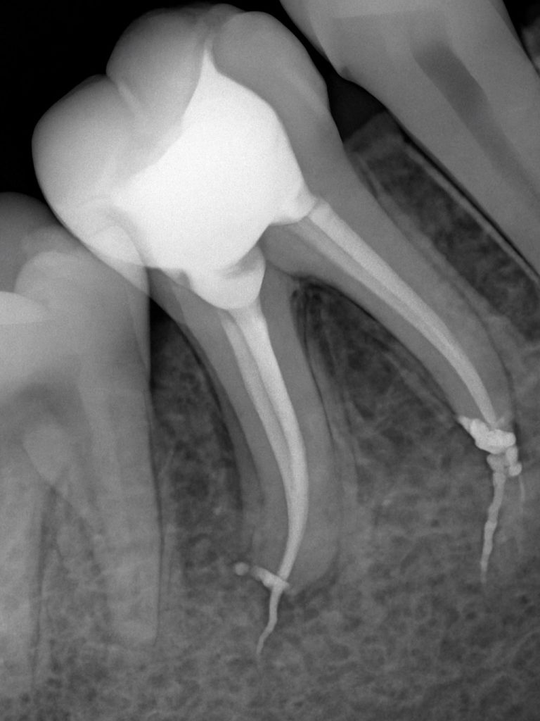 4EB941DB-C793-412B-B854-23E0F18F7F82