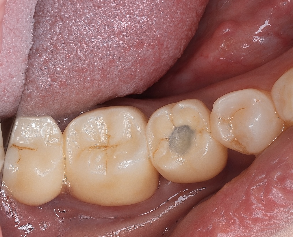 5987B2A8-B613-41E5-8D40-2641173B75C0