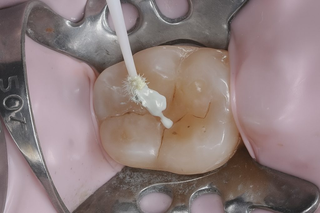 62A7A988-D360-42DE-9A22-F2E2629CD743