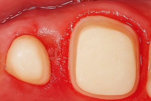 642D7B7A-FC67-45FF-90DD-0E3A334F8ACA