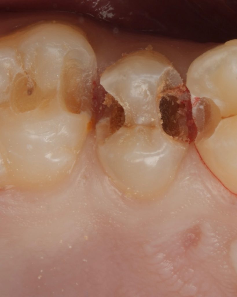 7A0C8D31-32CA-4802-9A96-52BD84B0C2D2