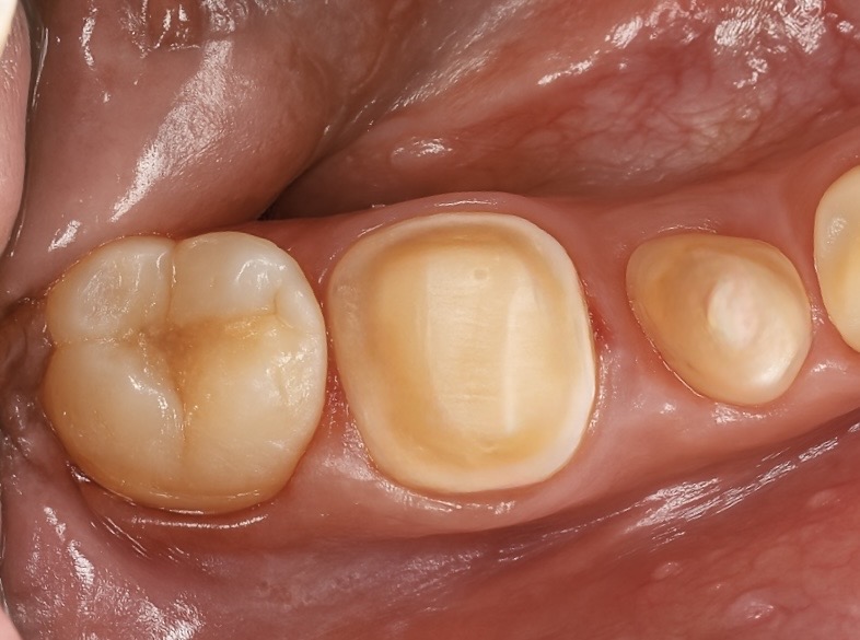 81147B85-CFB9-4BF1-9327-868FDACEFCF0