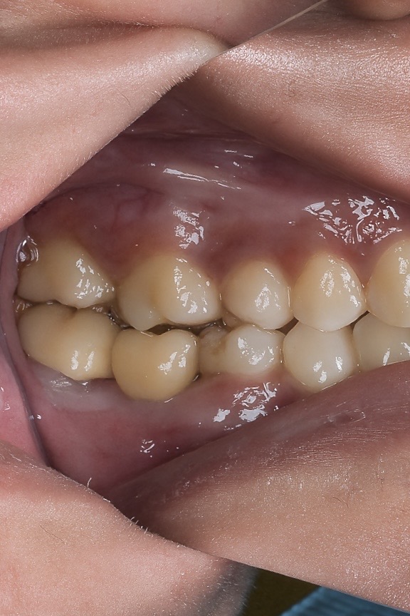 8FB46488-47D2-4F3A-B9F2-6C48BDE688A5