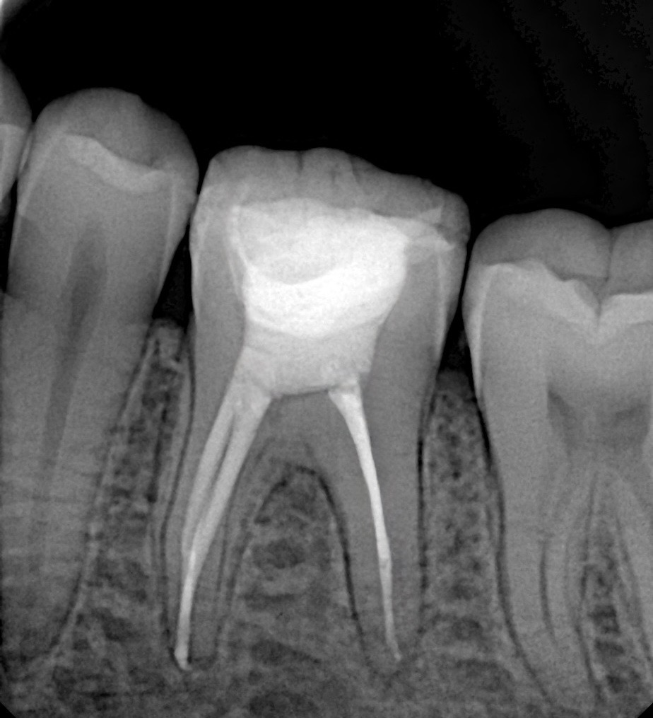 90a463d3-fd17-42f8-a7d4-bd713b3401f6