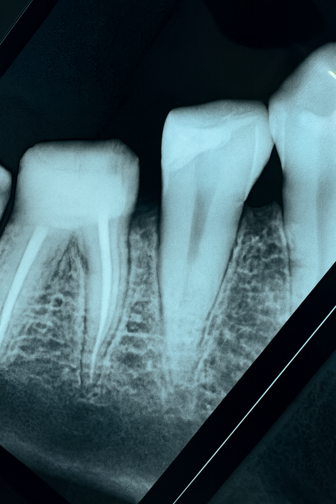 9287D3DE-12C9-4FBE-8C44-277020D3CDF5