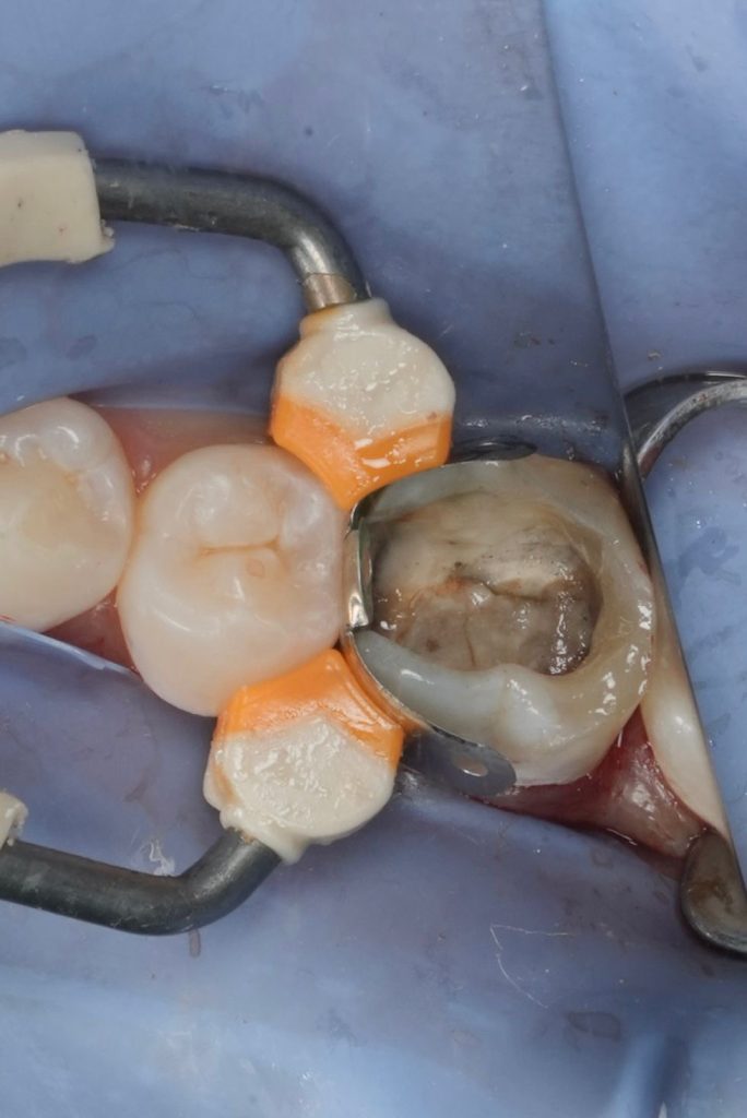 96a1151e-63eb-4bd7-9fcf-5fb27ac1a98a