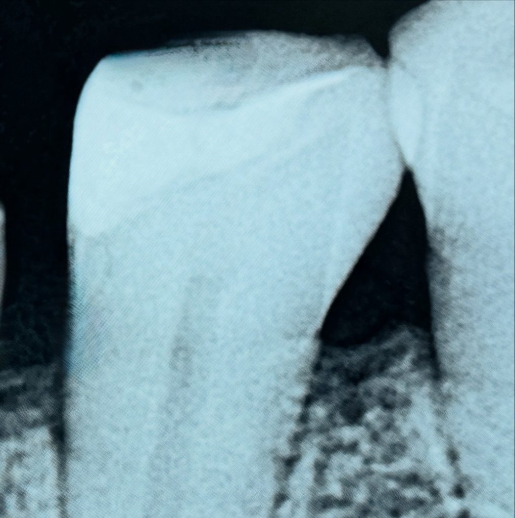 A6CD7E72-36C0-4A72-AA32-DB32ECCA08EF