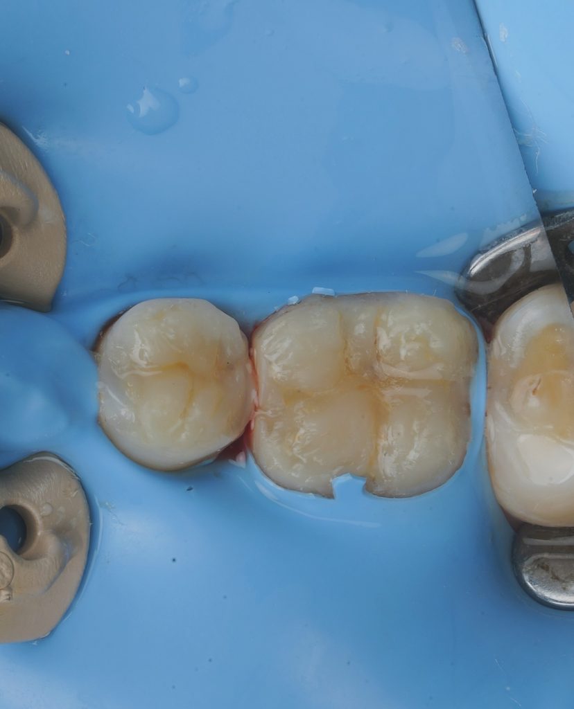 ADD33177-3601-437F-A580-7A79318AFEF7