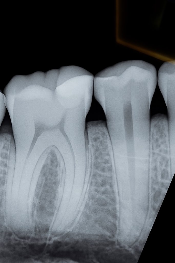 B0E1BFD1-AD35-435E-9665-1FE0BC404187