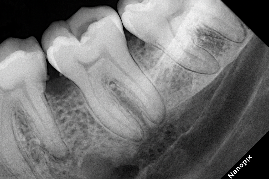 B9EB2CF0-1FBC-4868-8D3E-6B98D6010BEB