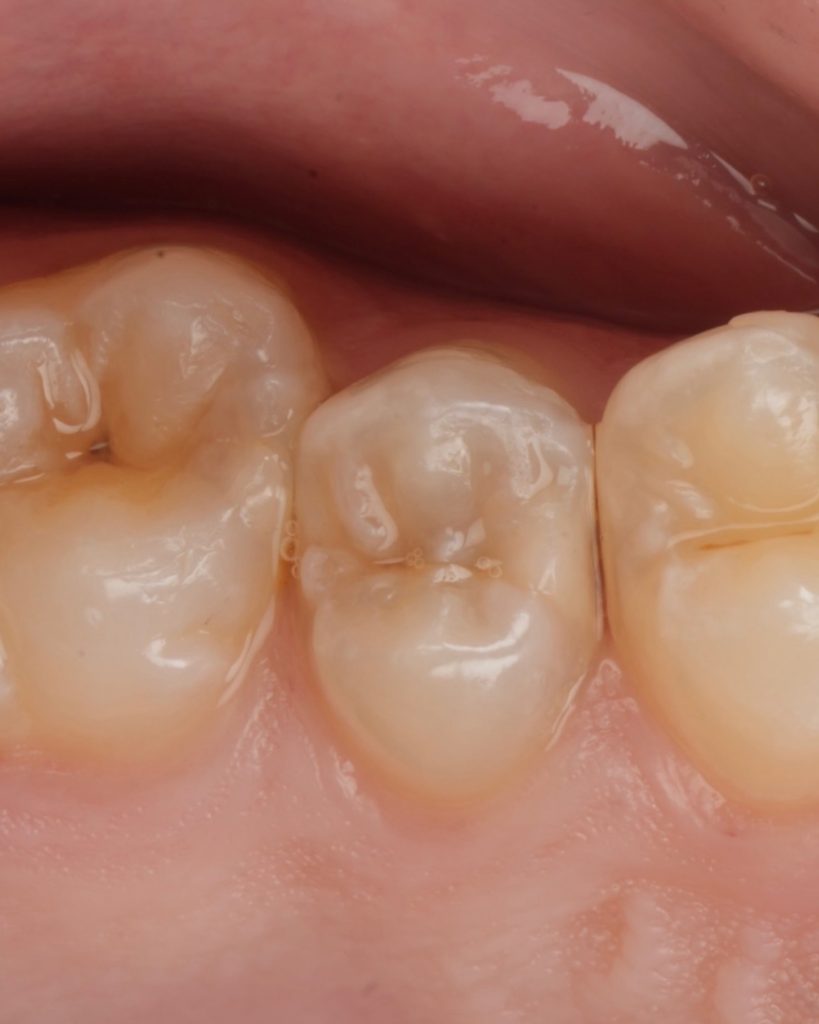 BAEECB25-02BD-44F9-90A2-5B94B0F1A844