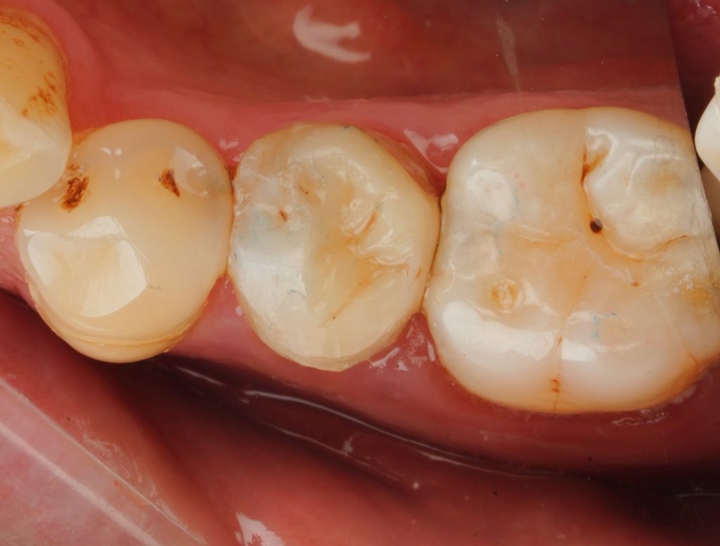 BC82A419-253A-4B4C-8CA6-9F655DBBB0DE