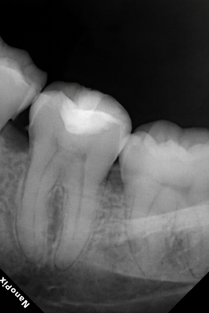 BF95450B-C4BA-4B73-BCFE-A6F0451D1D98