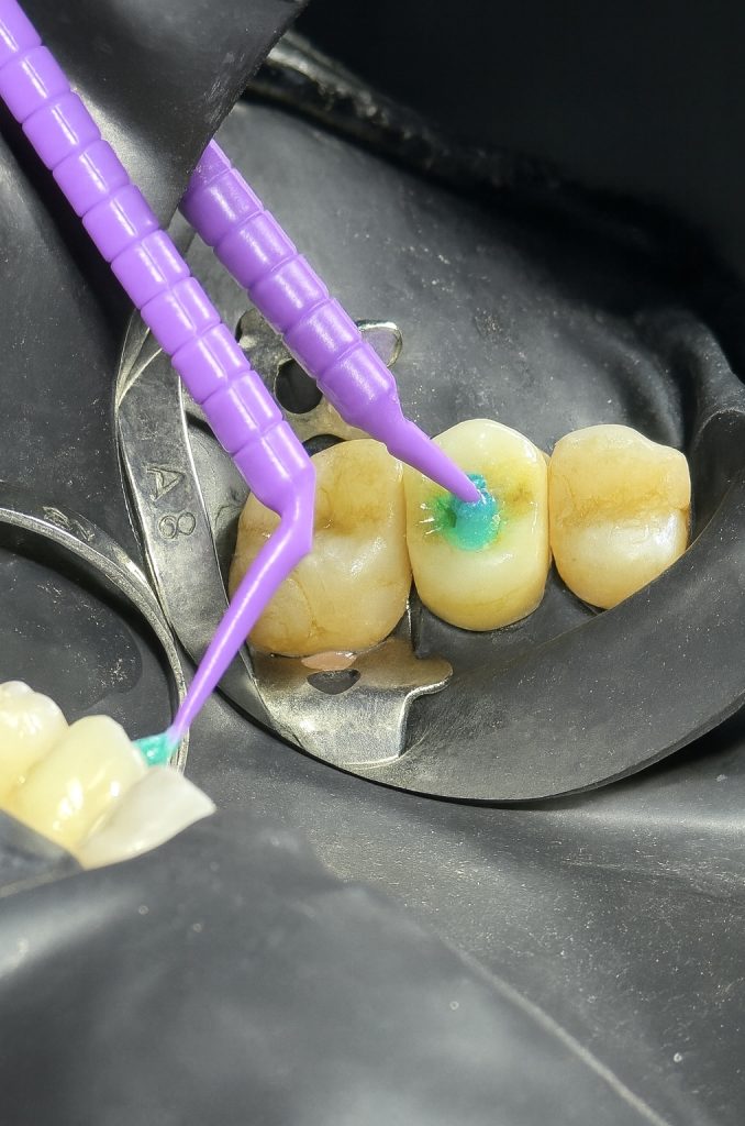 C0A68780-67B8-4A06-BF20-C0FDA84BB64E