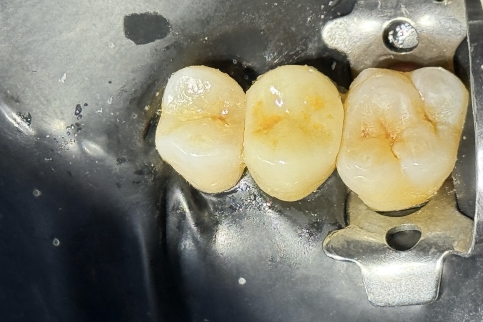 C5930478-AD83-47DB-B115-FAAB8201BDB8