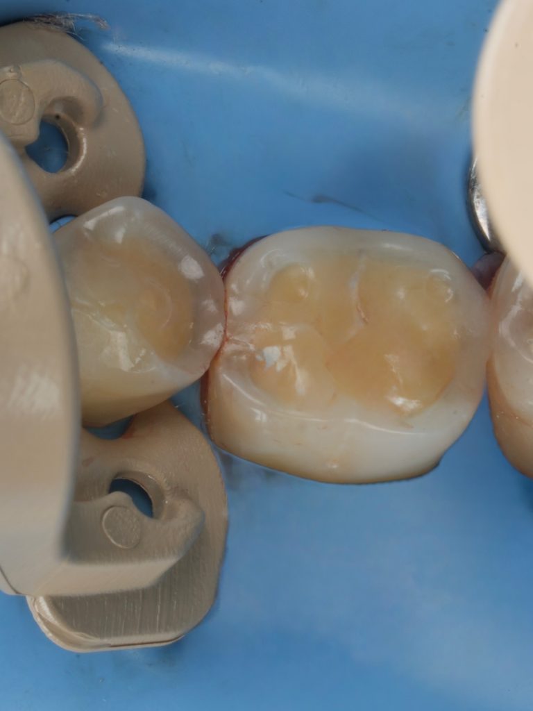 CA7B5BD9-4085-47BD-8CC5-952B7D5EA286