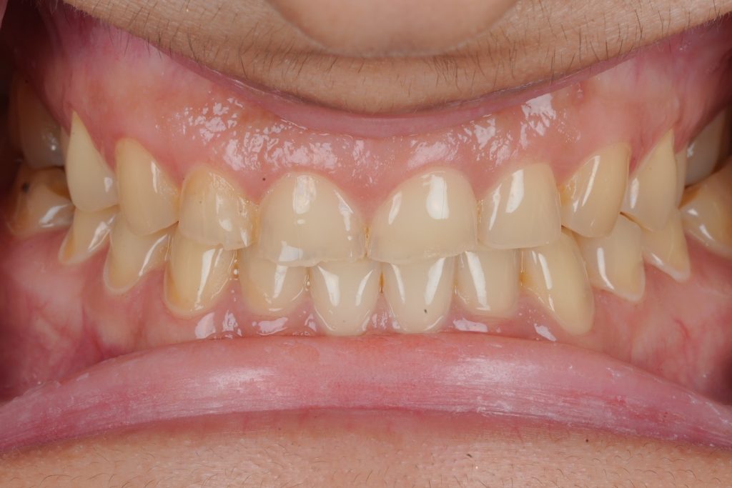 CF860817-A4CC-43C6-BFBC-799DBD381760