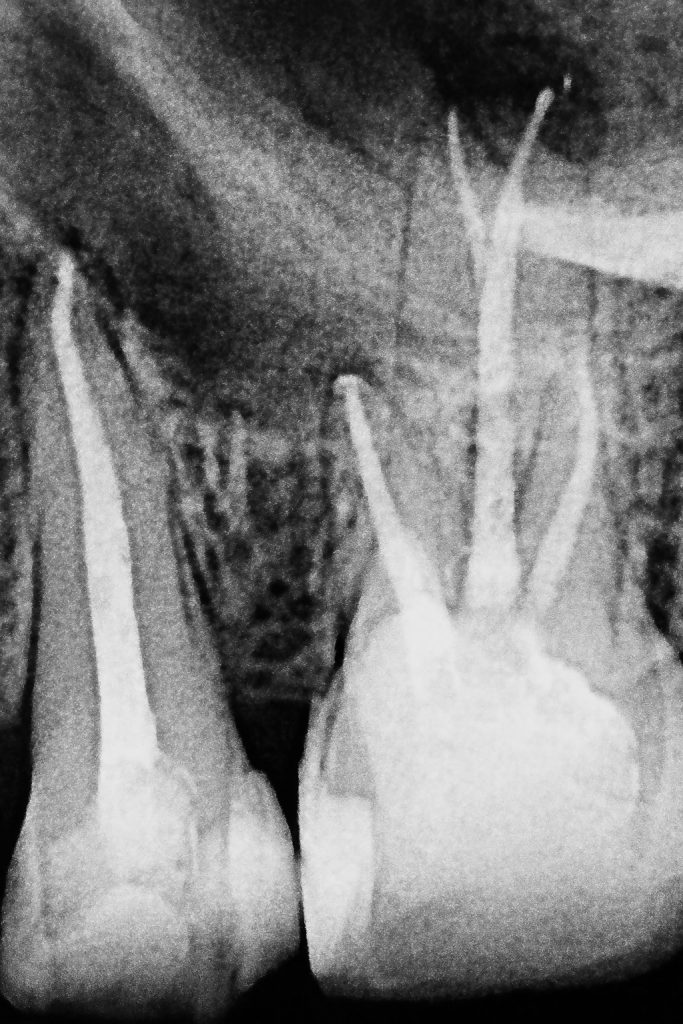 D47A4DE1-A39F-47C7-A591-94445EE80975