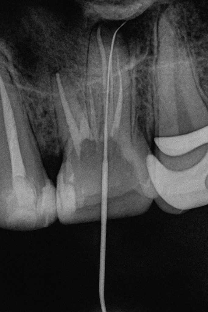 D79C8C75-8605-40A5-A344-9E3A736A45DE