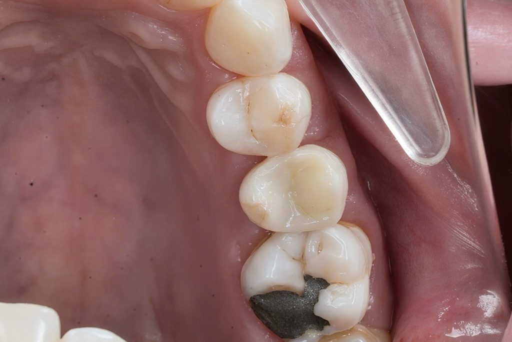 DE04EEA1-EB64-4235-9FF4-0BE1312959C7