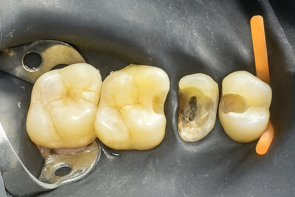 F0A0E0D0-EF23-437E-B16E-CB018AE1885B