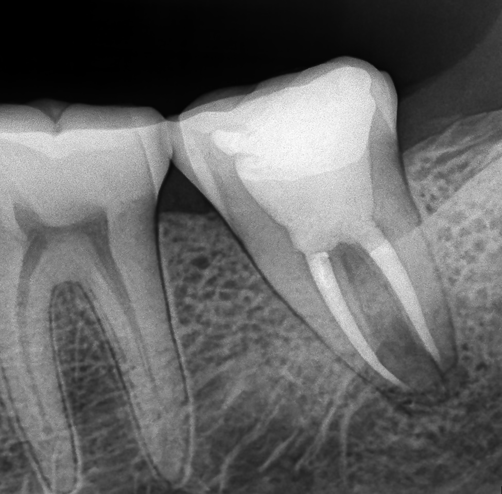 F246E092-BDE0-4981-814C-2FA190515404