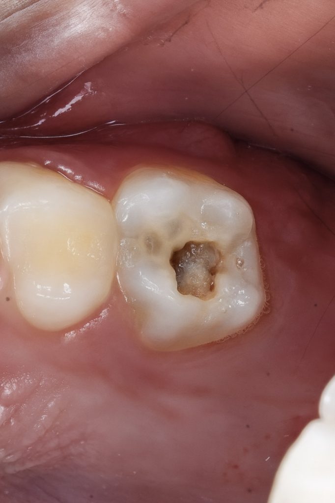 FC995732-F9C2-488A-A1E8-3DC8D3015B59