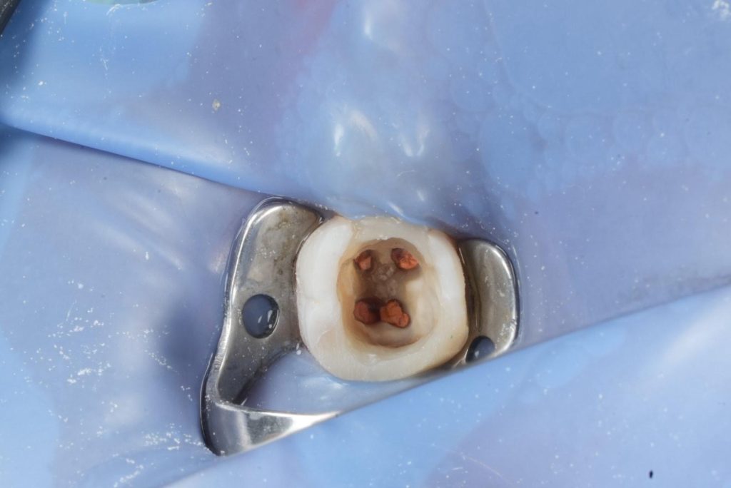 d4f78295-3d79-403e-96c7-471ccb8b75ae